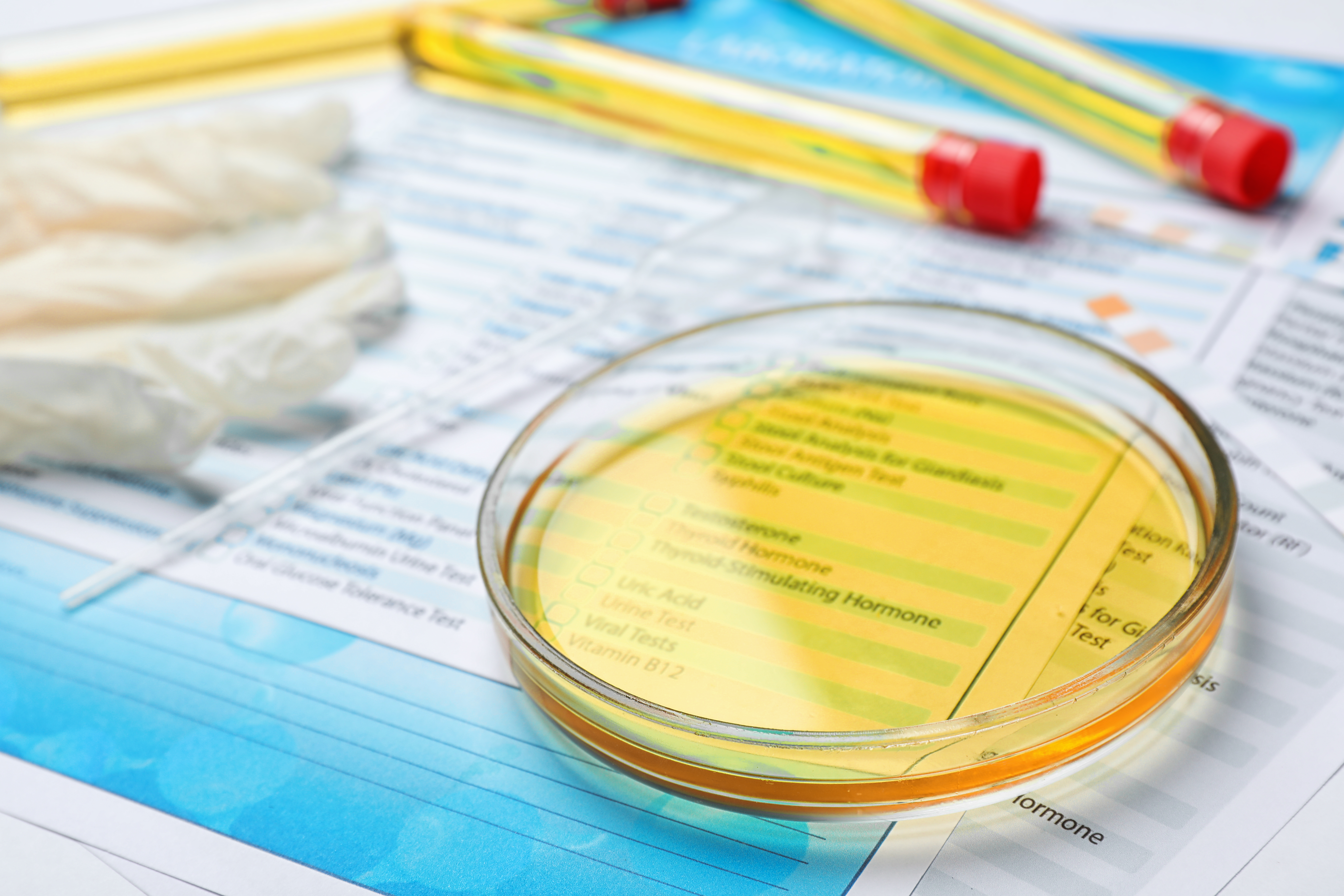 Urine sample being tested in a petri dish