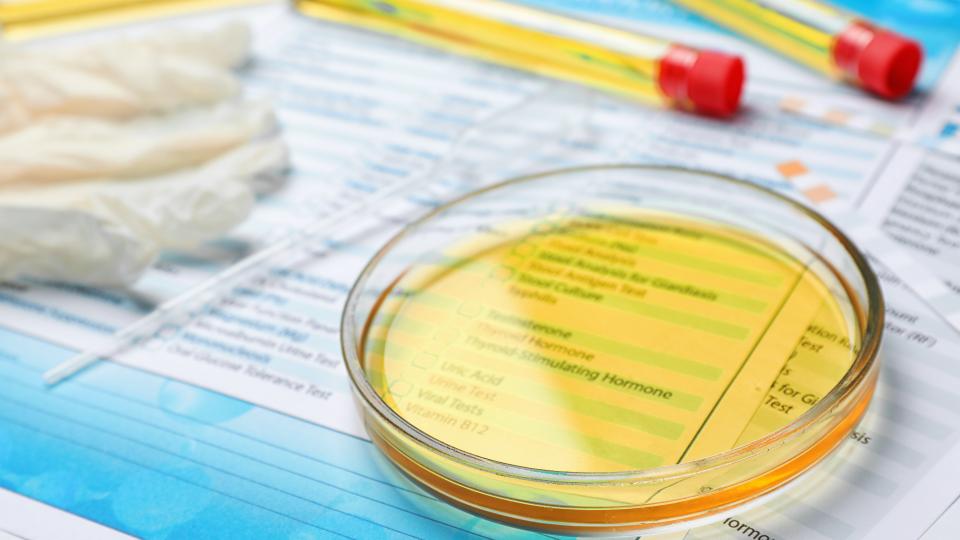 The AntiDoping Rules UK AntiDoping